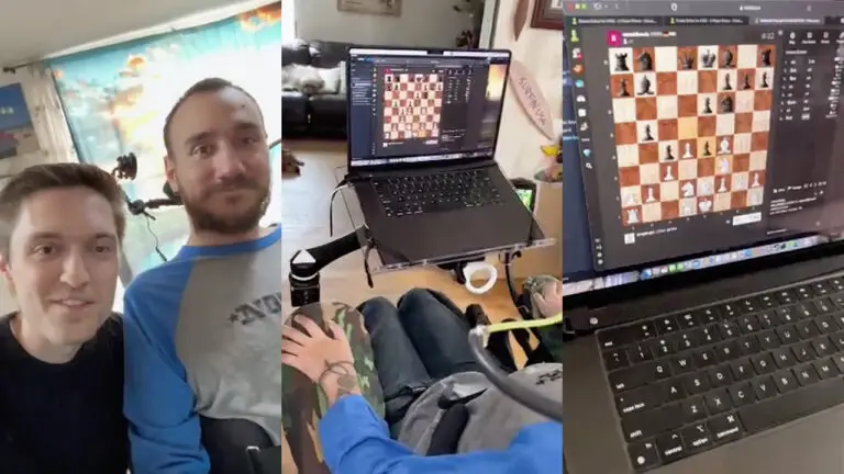 Первый в мире пациент с вживленным в мозг чипом научился играть в шахматы