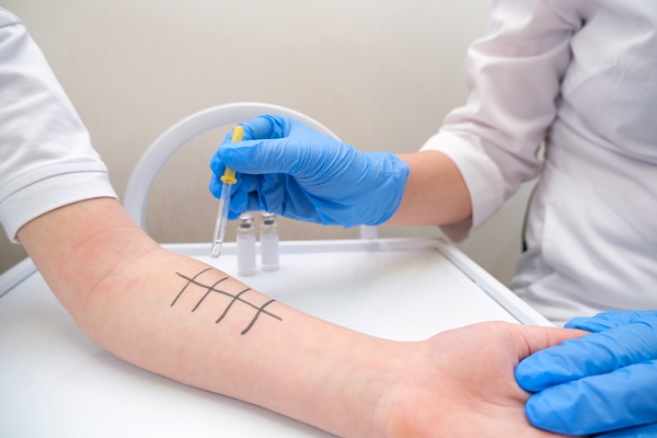 immunologist doing skin prick allergy test redness and peeling on the arm - Углеводная питательность рациона