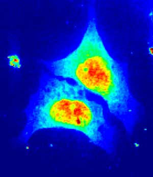 Впервые в мире получены рентгеновские снимки живой клетки