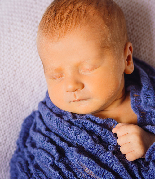 Желтуха новорожденных: симптомы и лечение