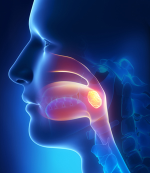 Что нужно знать об инфекциях носа и горла