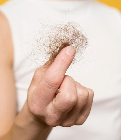 Причины чрезмерного выпадения волос