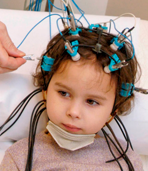 Эпилепсия у ребёнка: признаки, диагностика, лечение