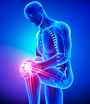 Деформирующий остеоартроз суставов — симптомы, лечение