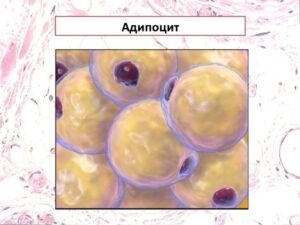 adipocit - Целлюлит. Рекомендации для достижения гладкой и упругой кожи