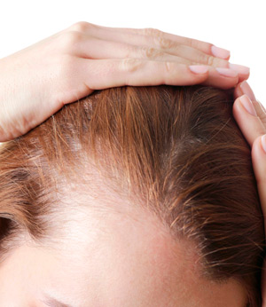 Диагностика выпадения волос. Какие анализы нужно сдать?